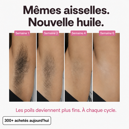 Huile anti-pilosité - PureVita