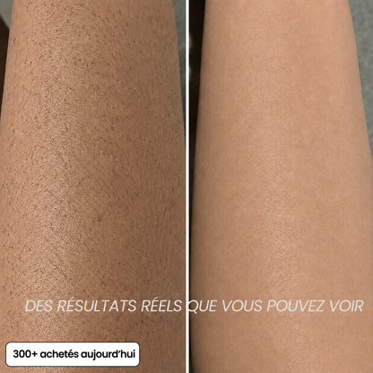 Huile anti-pilosité - PureVita
