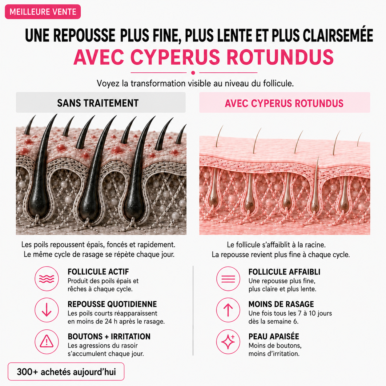 Huile anti-pilosité - PureVita