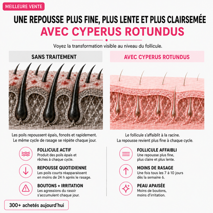 Huile anti-pilosité - PureVita