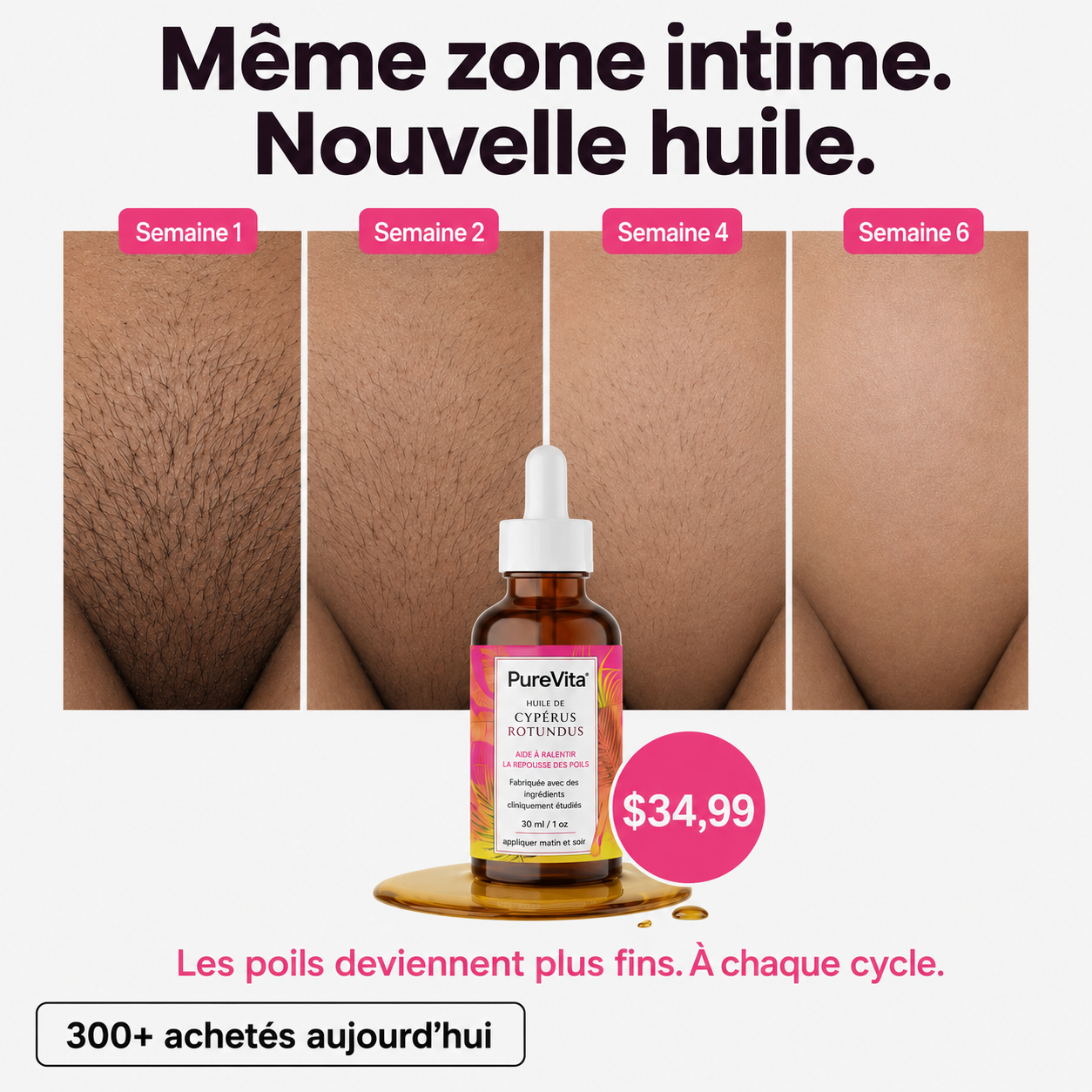 Huile anti-pilosité - PureVita