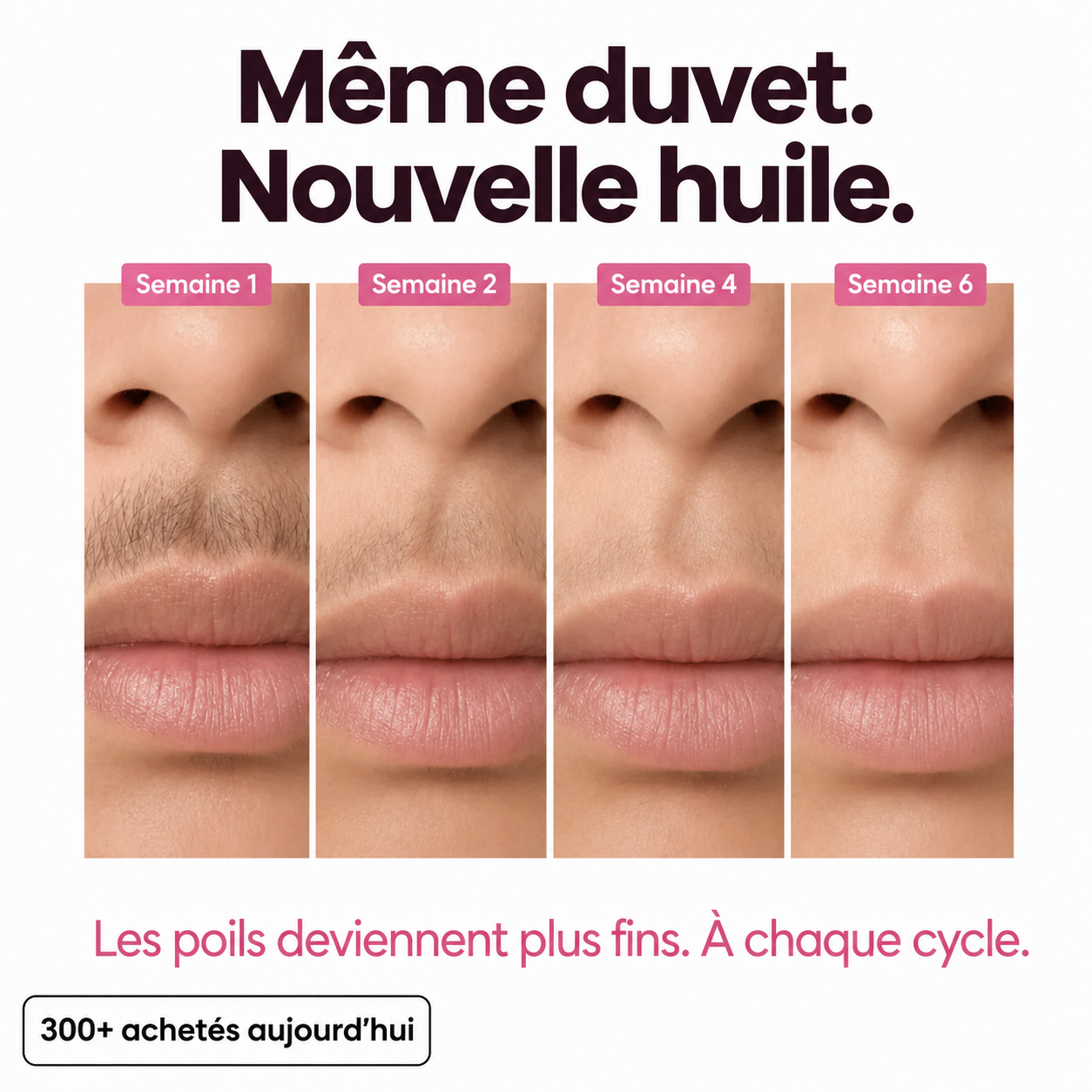 Huile anti-pilosité - PureVita