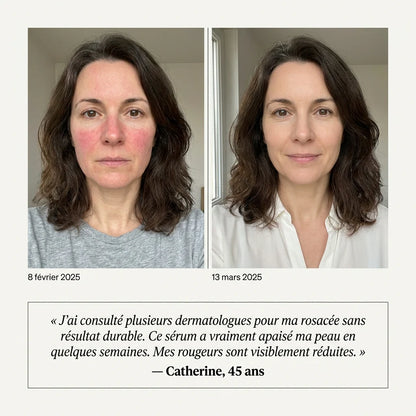 PureVita Sérum Anti-Rougeurs