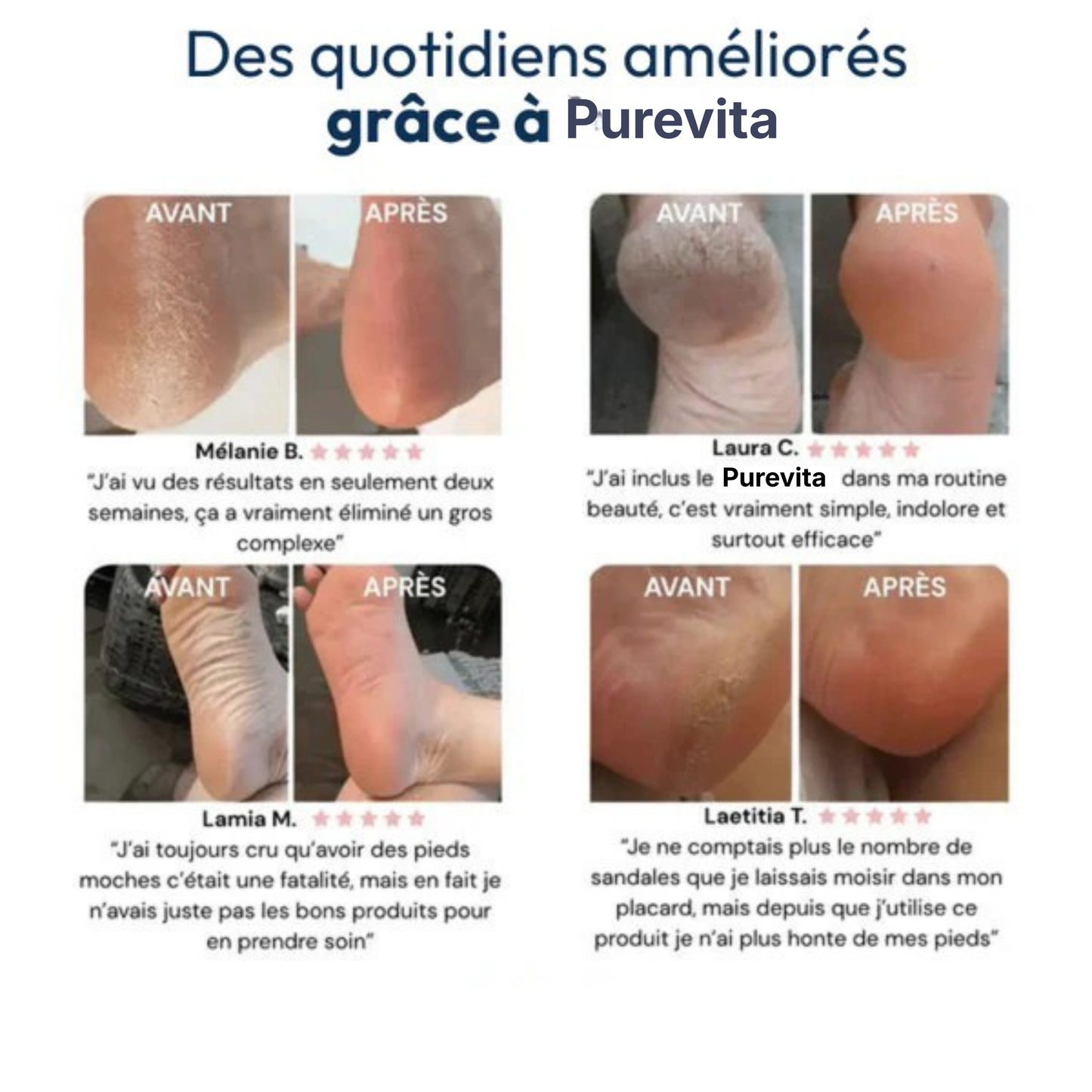 Masque peeling magique pour les pieds Purevita