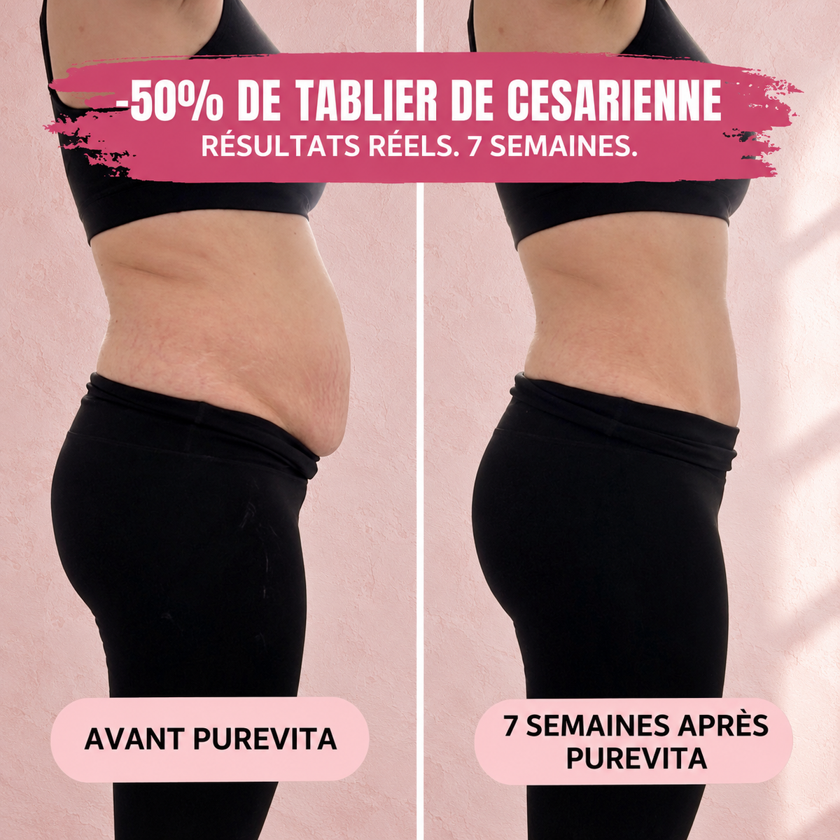 Culotte Post-Partum — Compression 360°