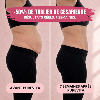 Culotte Post-Partum — Compression 360°